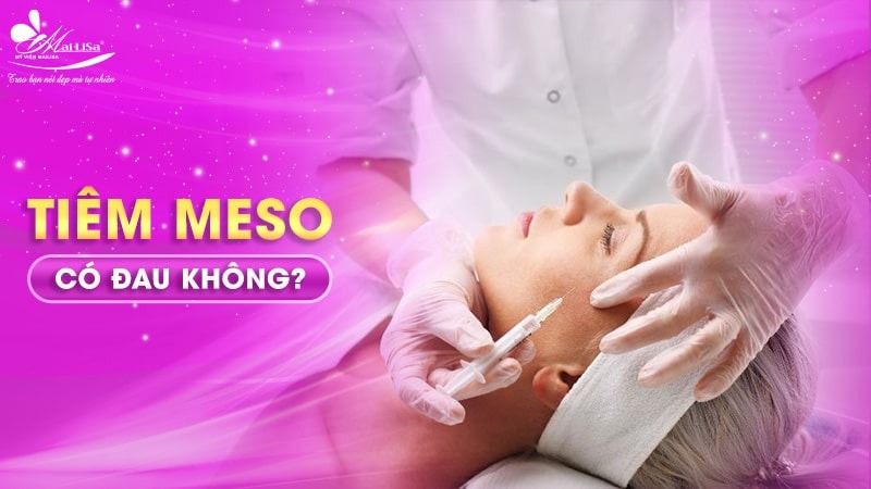 phuong-phap-tiem-meso