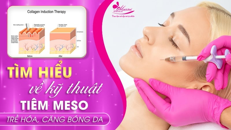 thuoc-tiem-mesotherapy
