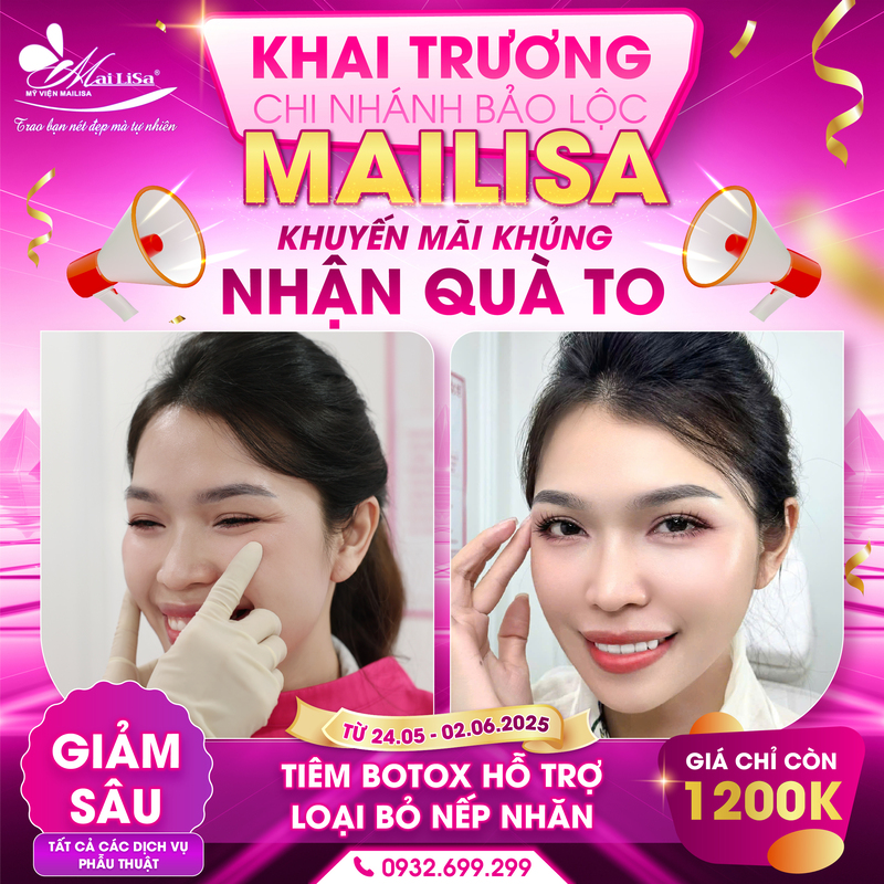 tiêm filler botox chuẩn y khoa tại mailisa bảo lộc