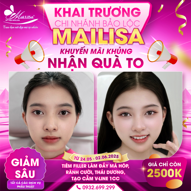 khuyen-mai-khai-truong-mailisa-bao-loc-chi-nhanh-17