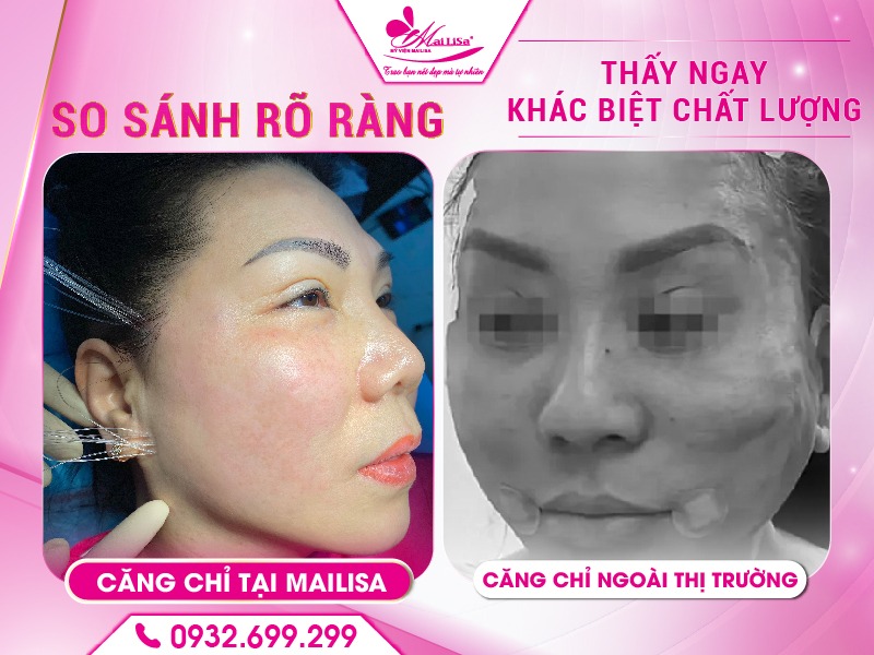 cang-da-mat-co-gay-bam-tim-khong