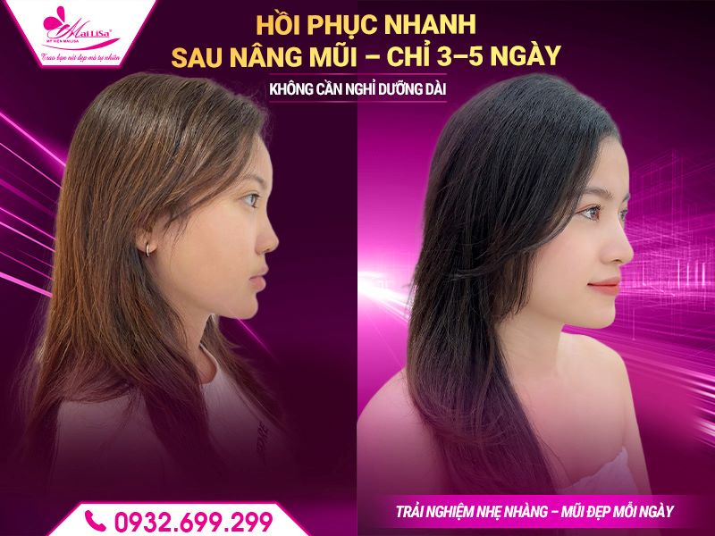 hoi-phuc-nhanh-khong-dau