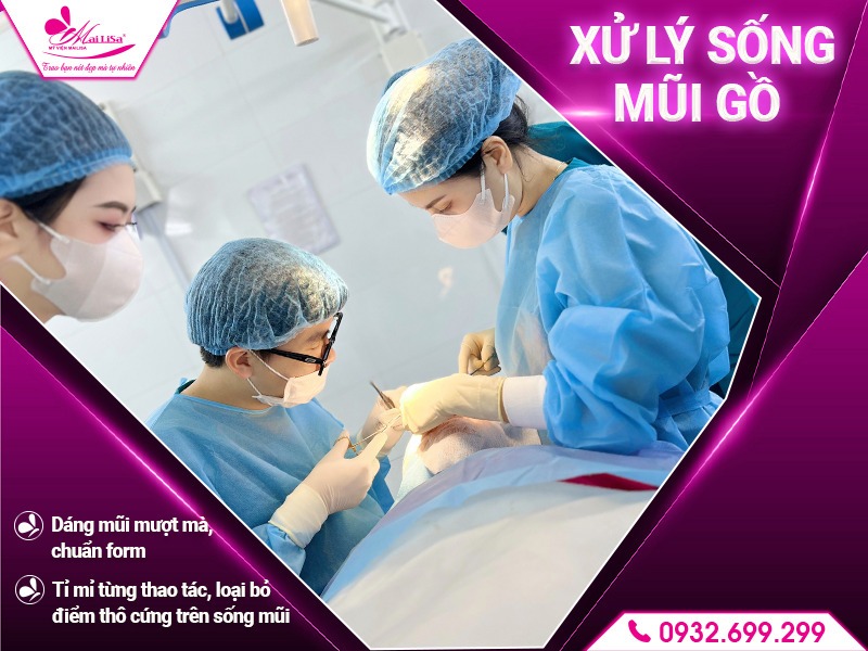 cach-massage-giup-giam-dau-sau-nang-mui