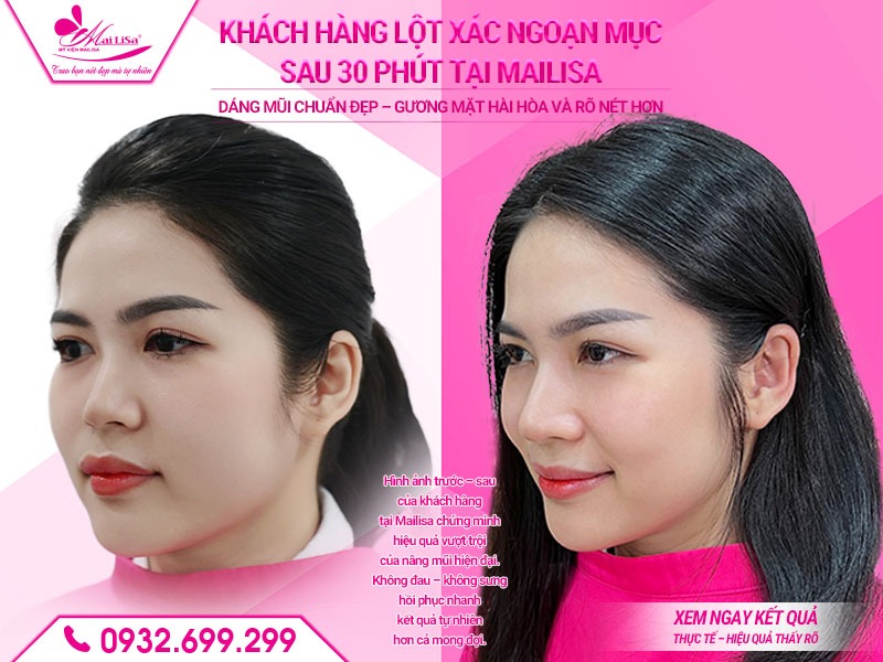 co-nen-nang-mui-khong-ai-phu-hop-voi-nang-mui