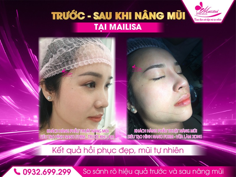 dau-hieu-bat-thuong-sau-nang-mui