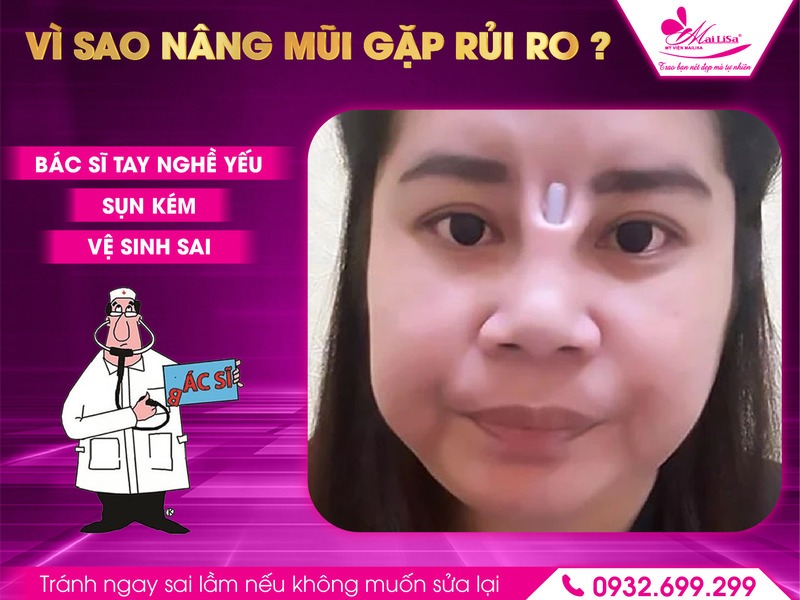 dau-hieu-bat-thuong-sau-nang-mui