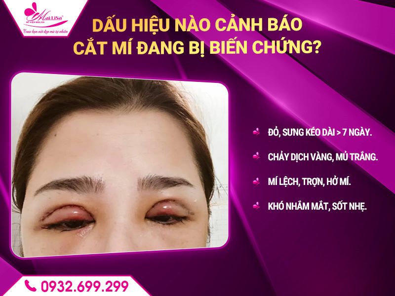 dau-hieu-bien-chung-sau-khi-cat-mi