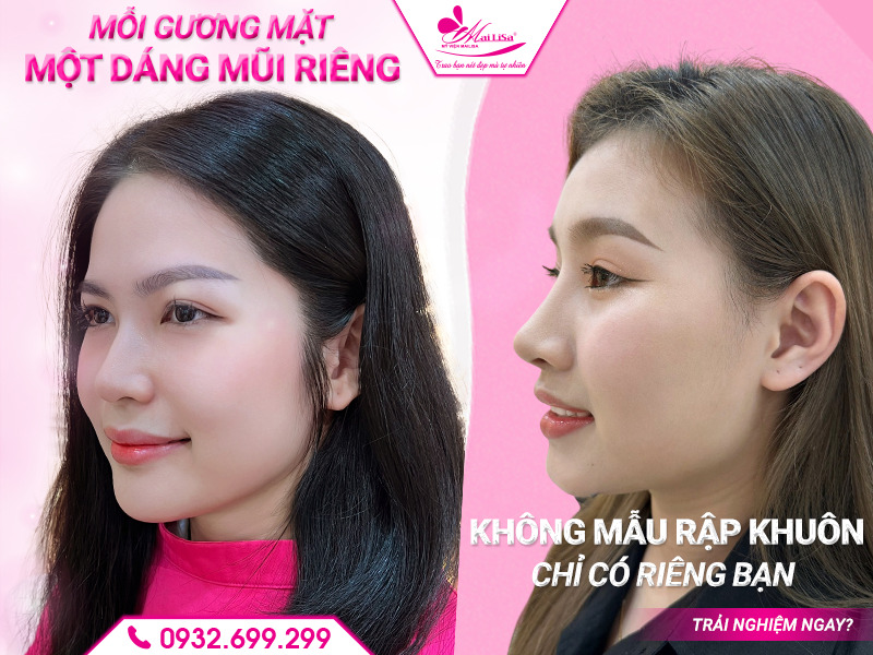 nang-mui-co-dau-lam-khong