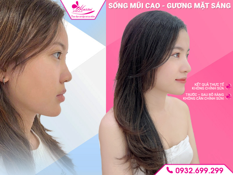 nang-mui-co-dau-lam-khong