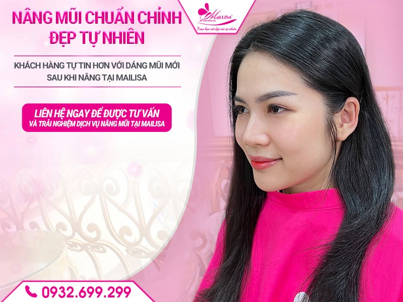 phau-thuat-nang-mui-keo-dai-bao-lau