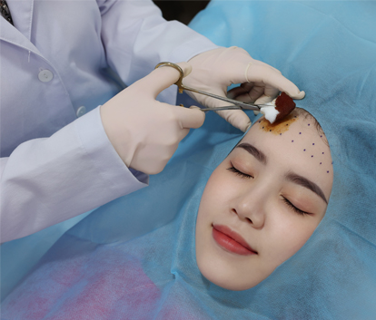 BOTOX-TRAN