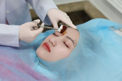 LAM DEP BOTOX