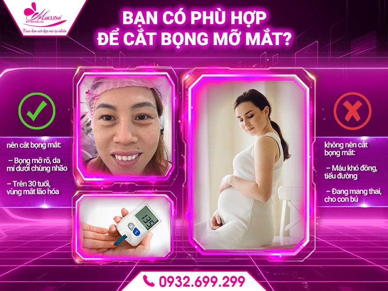 ban-co-phu-hop-de-cat-bong-mo-mat