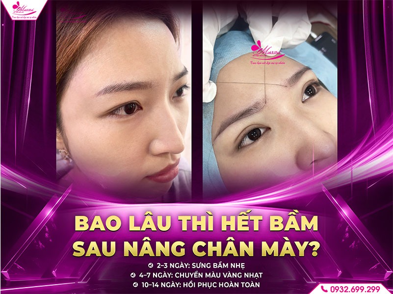 sau-nang-cung-chan-may-co-bi-bam-khong