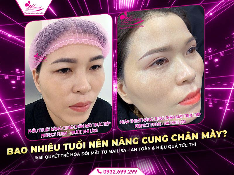 bao-nhieu-tuoi-nen-nang-cung-chan-may