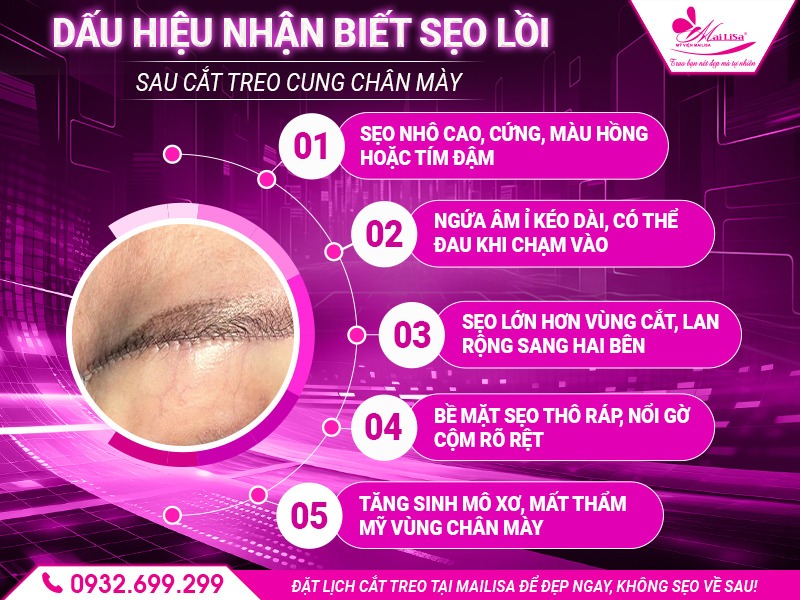 bi-seo-loi-sau-cat-treo-phai-lam-sao