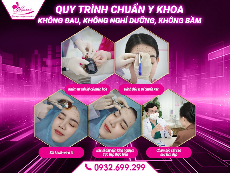 botox-tri-nep-nhan
