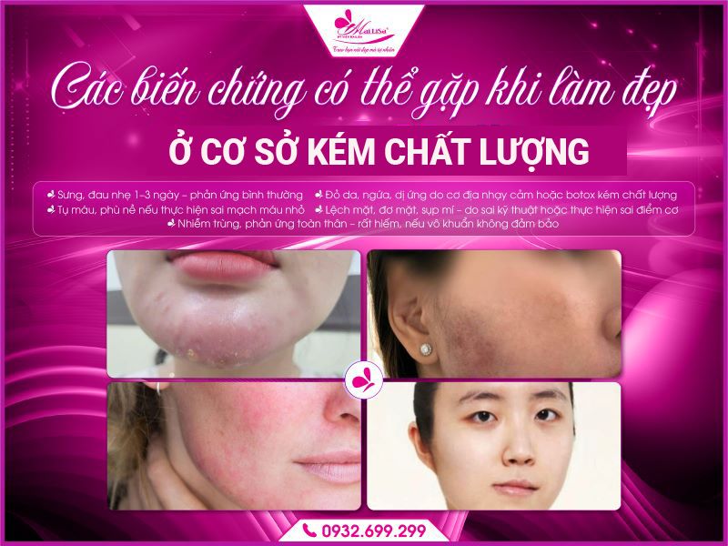 cac-bien-chung-co-the-gap-khi-lam-dep-botox