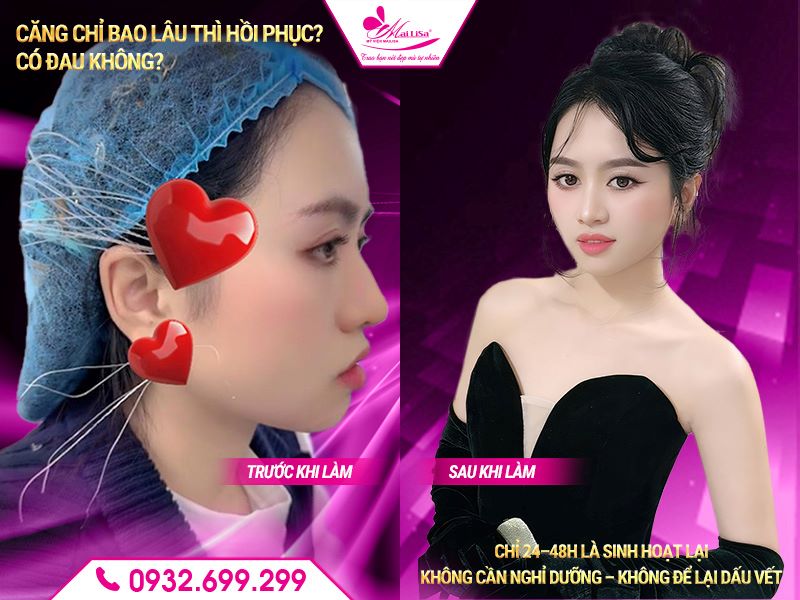 cang-chi-bao-lau-thi-hoi-phuc