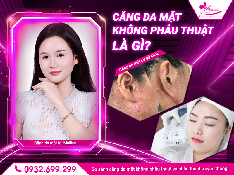 cang-da-mat-khong-phau-thuat-la-gi