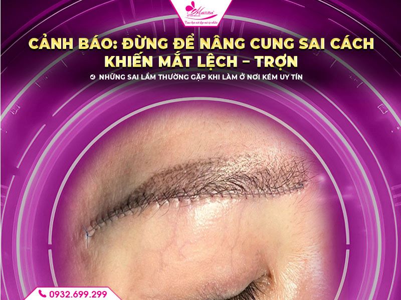 canh-bao-dung-de-nang-cung-sai-cach