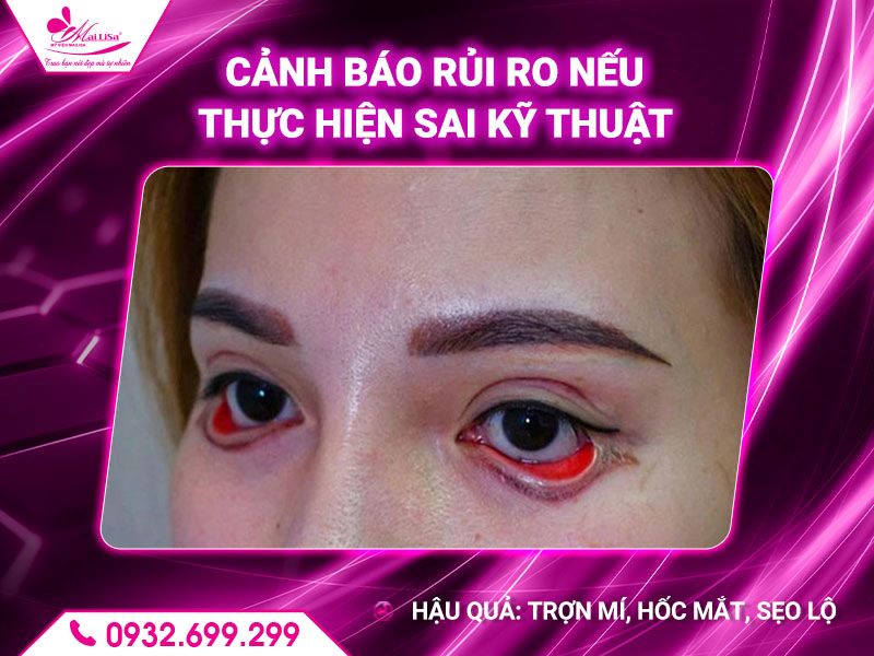 canh-bao-rui-ro-neu-thuc-hien-sai-ky-thuat