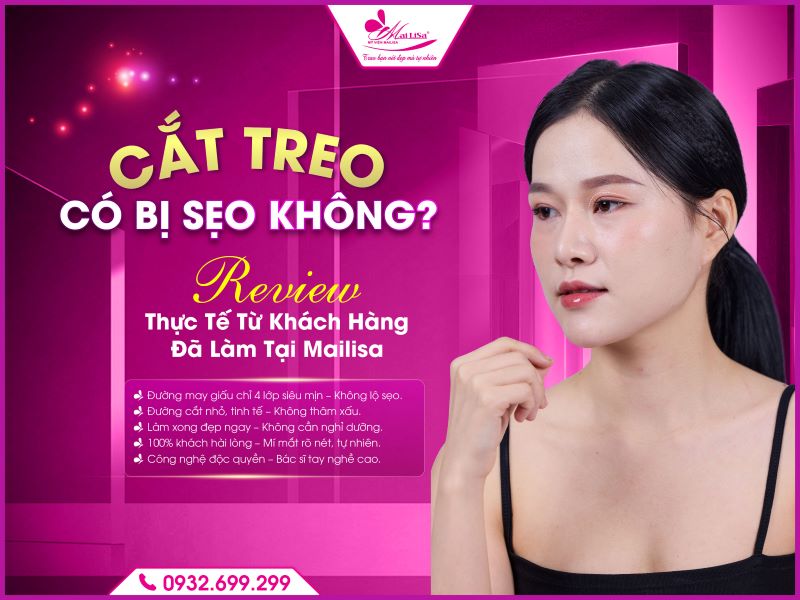 cat-treo-co-bi-seo-khong-7-yeu-to-khong-de-lai-seo