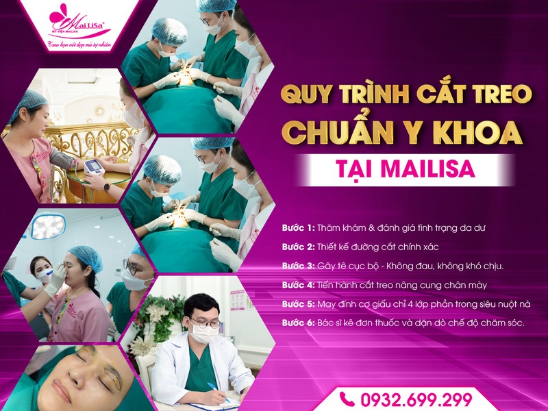 cham-soc-sau-khi-cat-treo-de-khong-bi-seo
