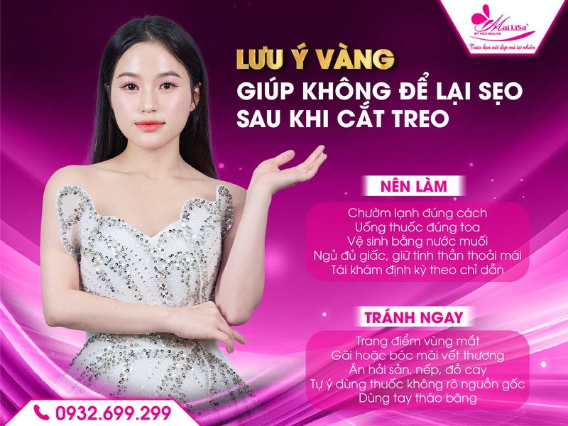cham-soc-sau-khi-cat-treo-de-khong-bi-seo