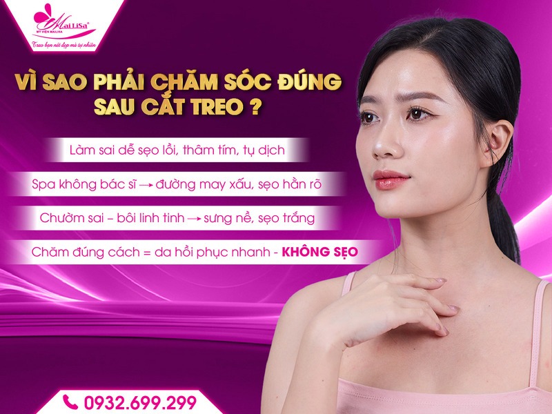 cham-soc-sau-khi-cat-treo-de-khong-bi-seo