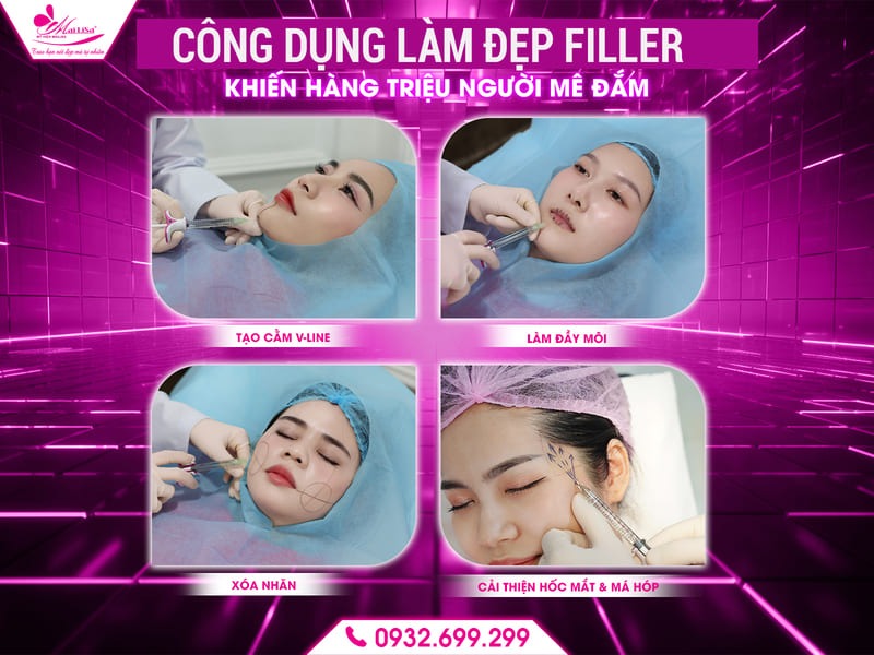cong-dung-lam-dep-filler