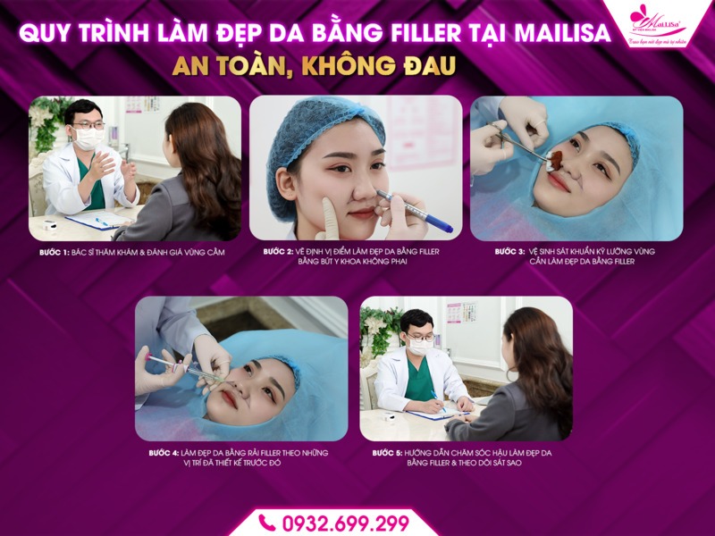 cong-dung-lam-dep-filler