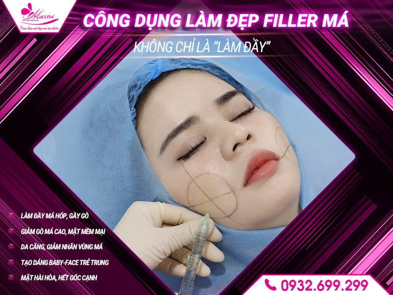 cong-dung-lam-dep-filler-ma