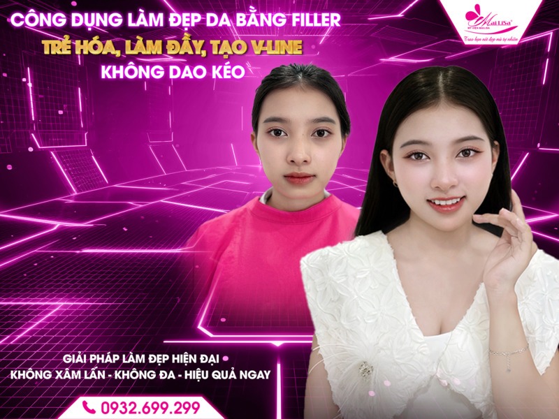 cong-dung-lam-dep-filler
