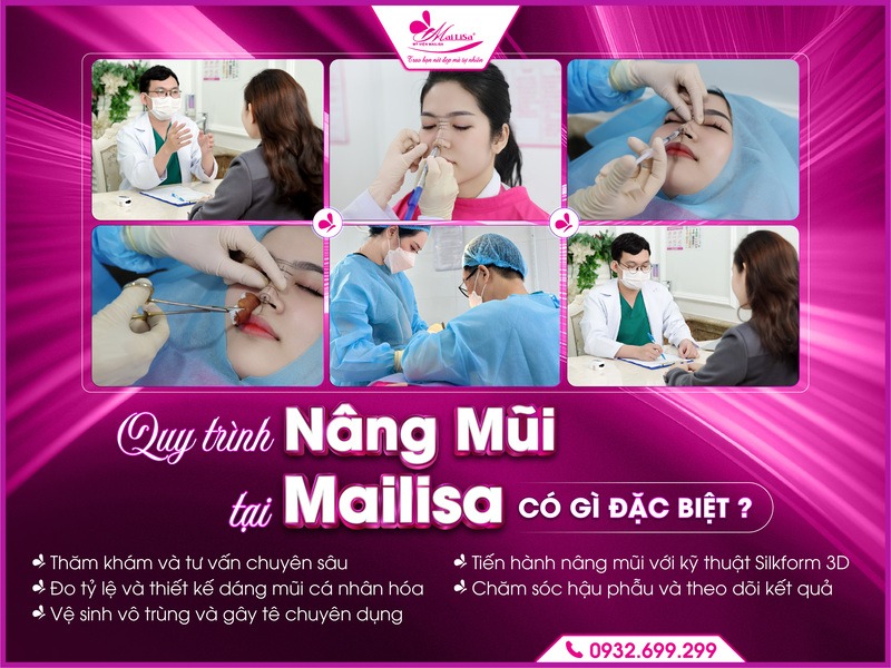 cong-nghe-silkform-3d-tai-mailisa