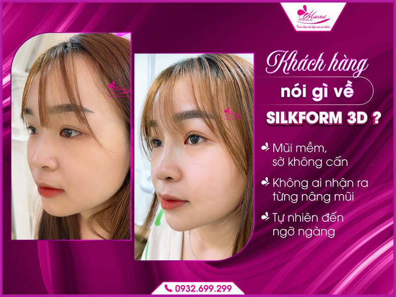 cong-nghe-silkform-3d-tai-mailisa