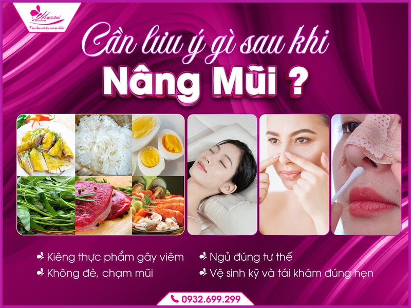 cong-nghe-silkform-3d-tai-mailisa