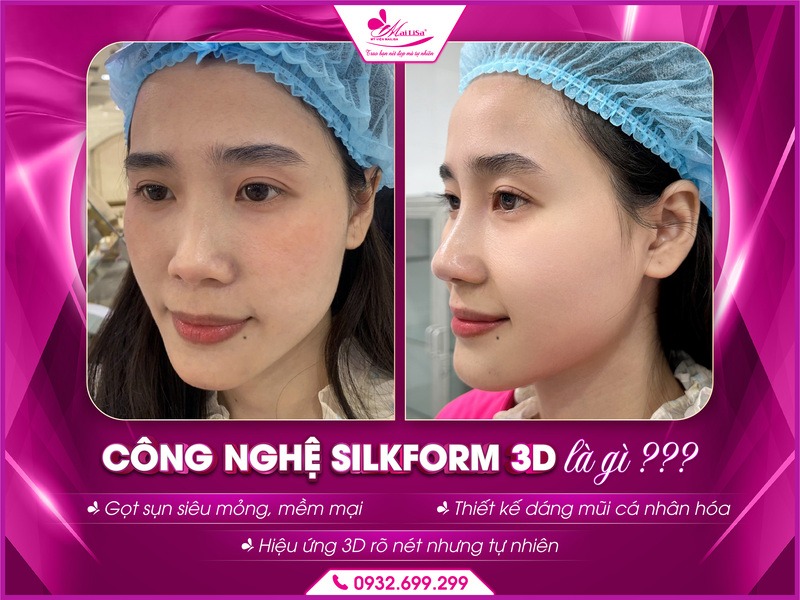 cong-nghe-silkform-3d-tai-mailisa