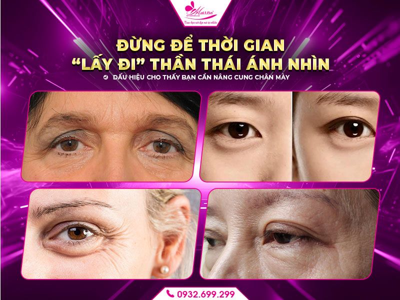 dung-de-thoi-gian-lay-di-than-thai-anh-nhin