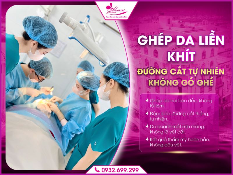 ghep-da-lien-khit