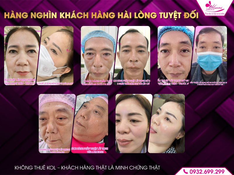 hang-nghin-khach-hang-hai-long-tuyet-doi