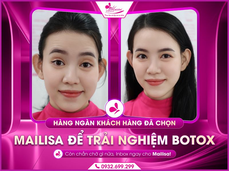 khach-hang-da-chon-mailisa-de-trai-nghiem-botox