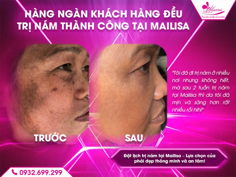 khach-hang-dieu-tri-thanh-cong