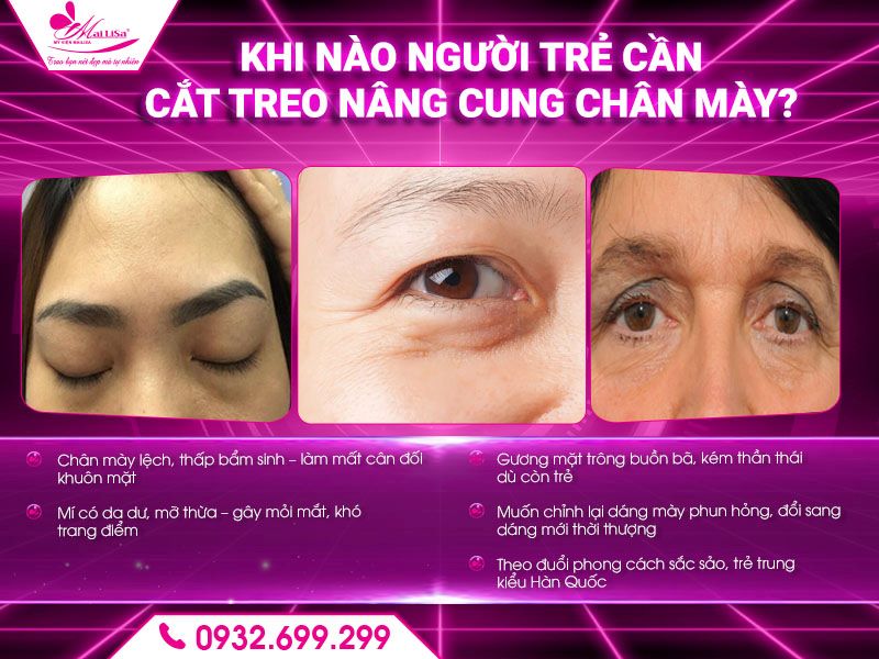 khi-nao-nguoi-tre-can-cat-treo-nang-cung-chan-may