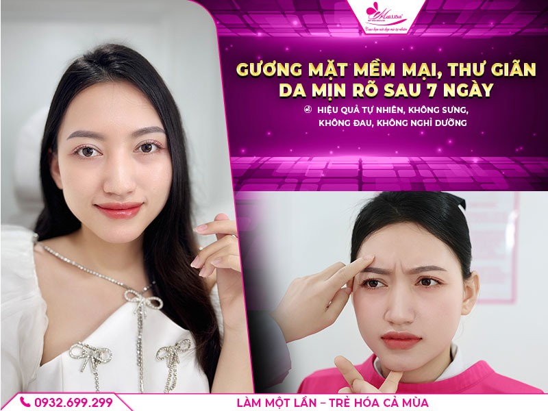 lam-dep-bang-botox-dep-tu-nhien