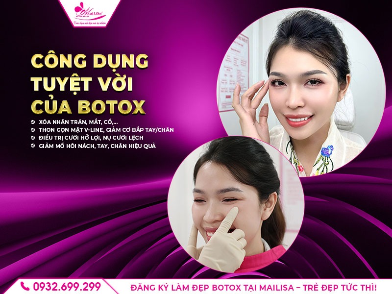 https://mailisa.com lam-dep-botox-la-gi