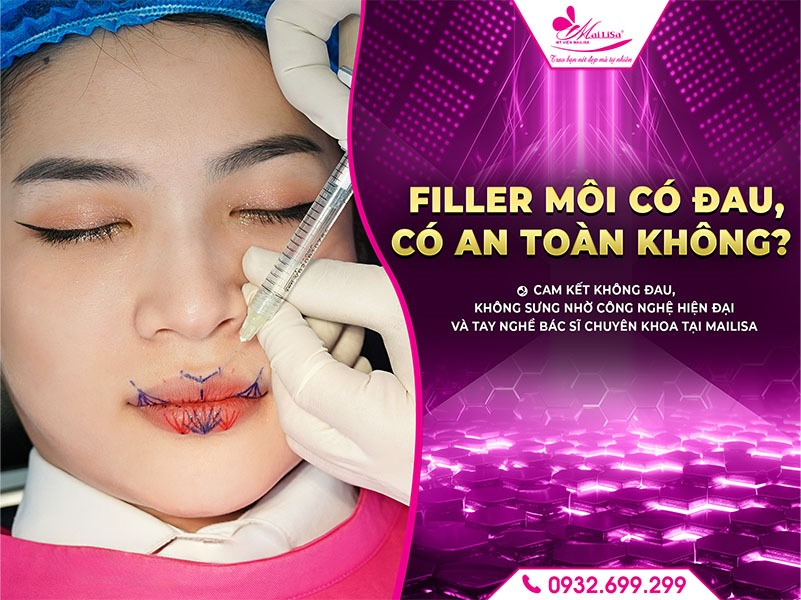 lam-dep-filler-moi