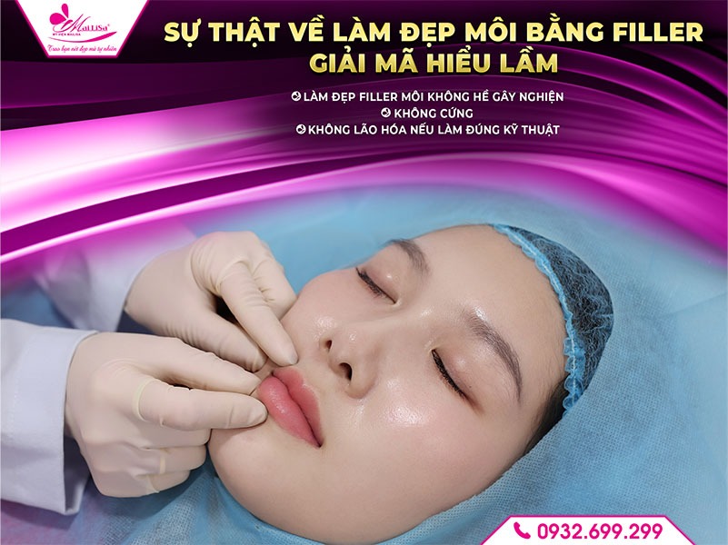 lam-dep-filler-moi