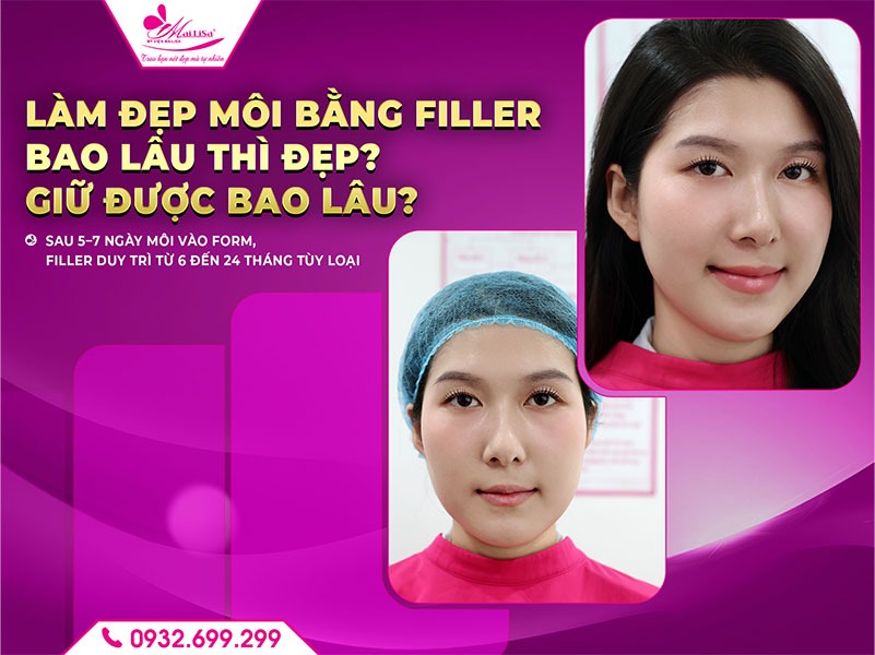 lam-dep-filler-moi