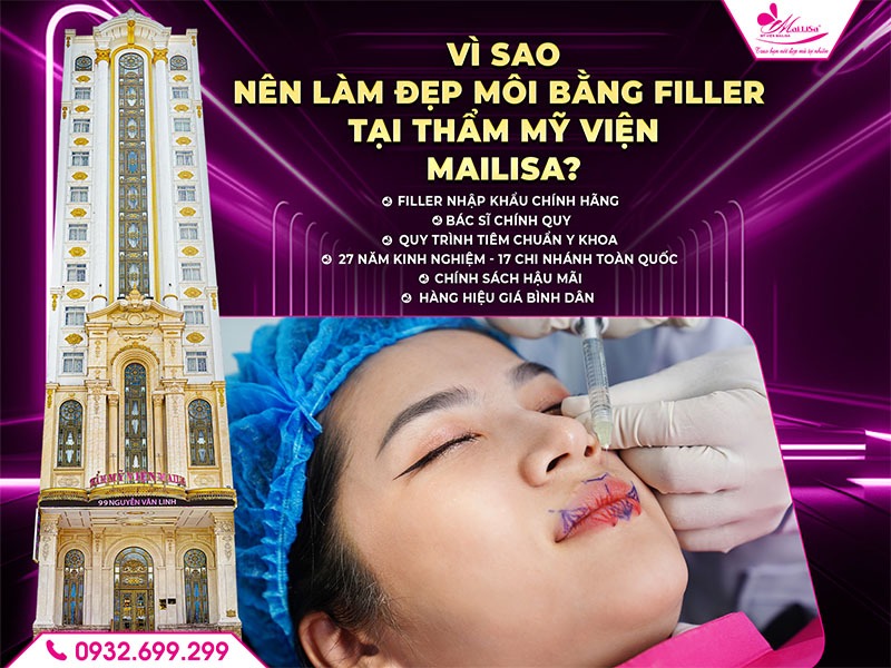 lam-dep-filler-moi